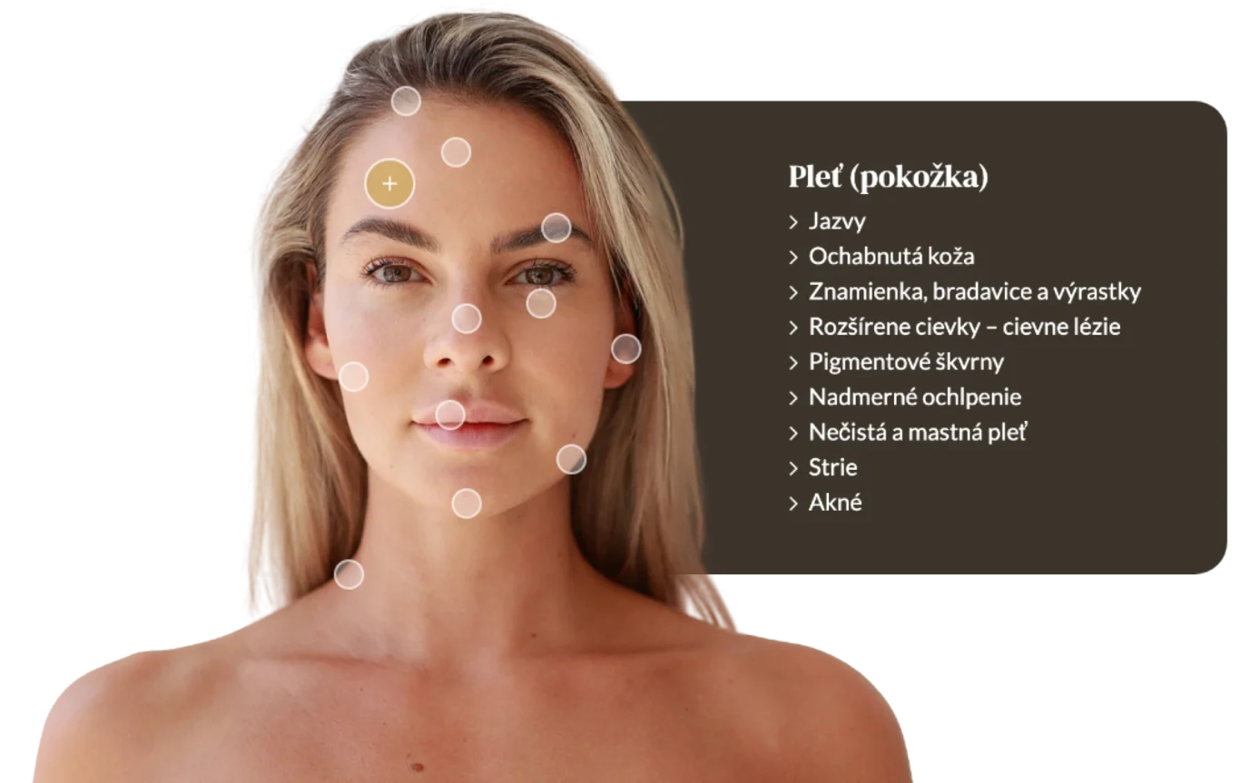 DermaPoint